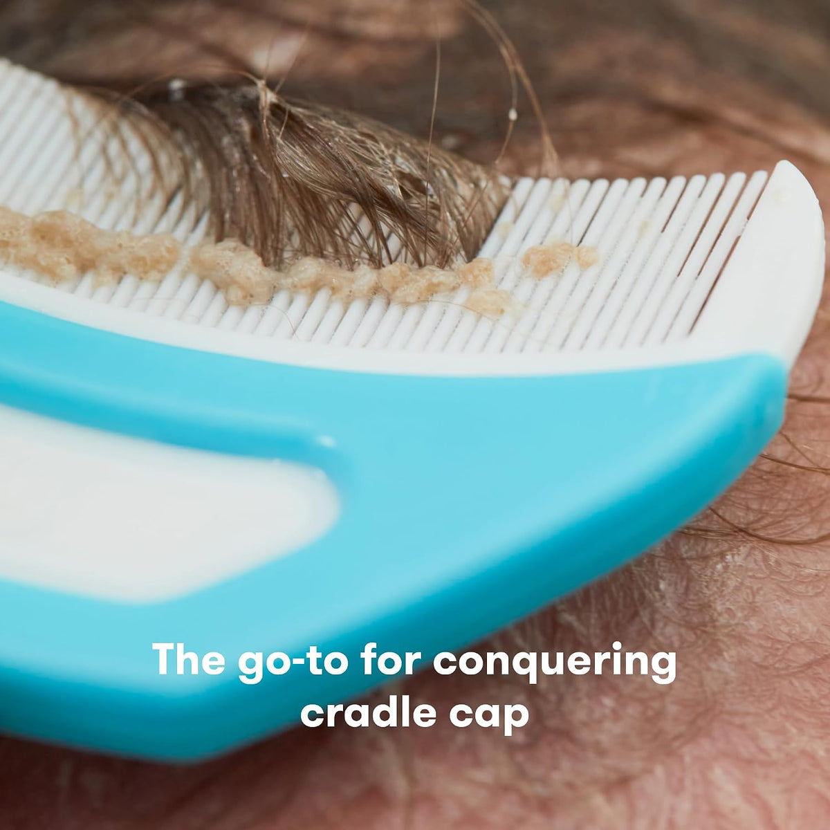 Frida The 3-Step Cradle Cap System, DermaFrida FlakeFixer, White-Blue