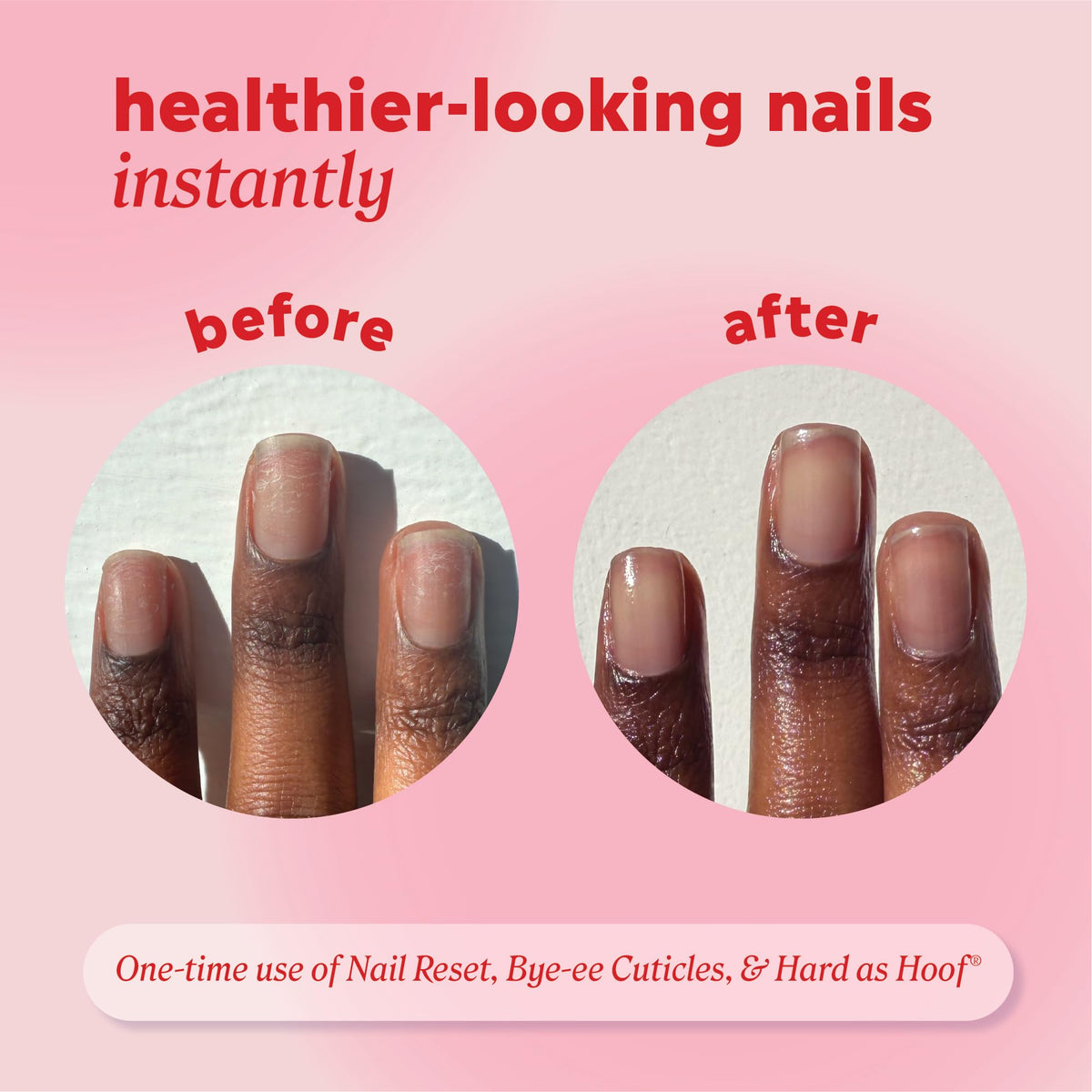 Onyx Professional Hard as Hoof Nail Repair Patches, 20 Patches