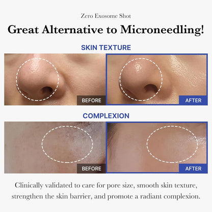 medicube Exosome Shot Zero 2,000 PPM Spicule Facial Serum For Pores & Sebum