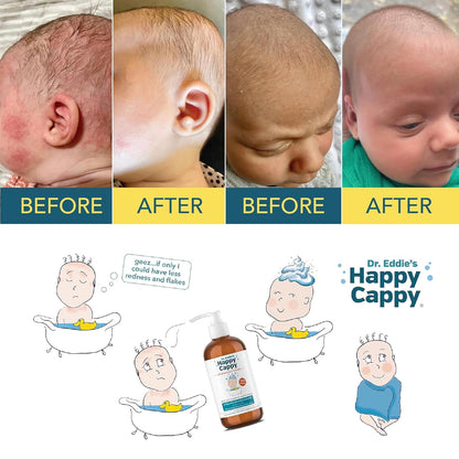 Happy Cappy Medicated Shampoo and Body Wash with Beanie Brush - 2 Pieces