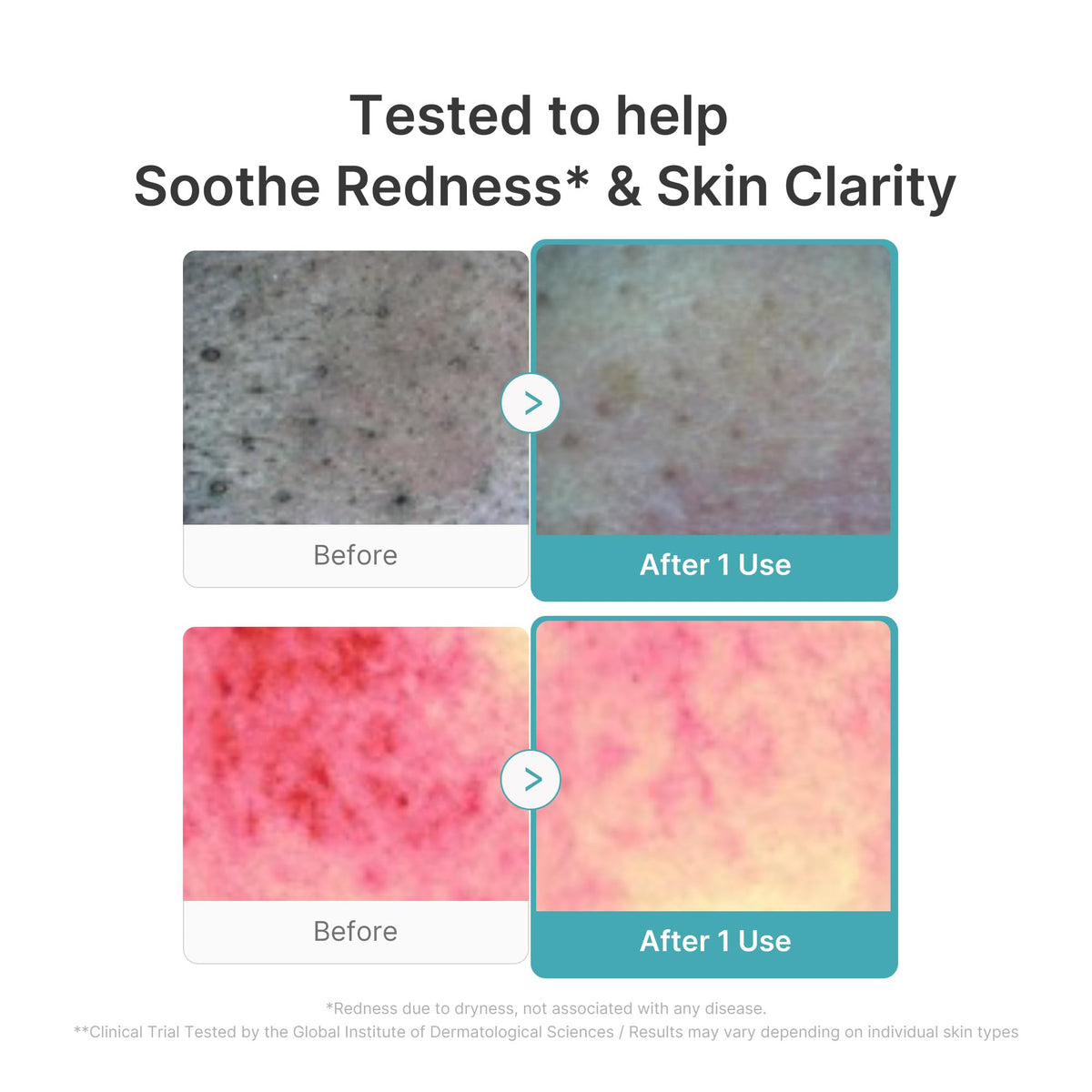 medicube Facial Cleanser PDRN Pink Glutathione Capsule Foam Cleanser