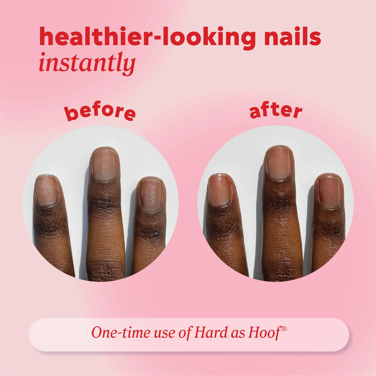 Onyx Professional Hard as Hoof Nail Repair Patches, 20 Patches
