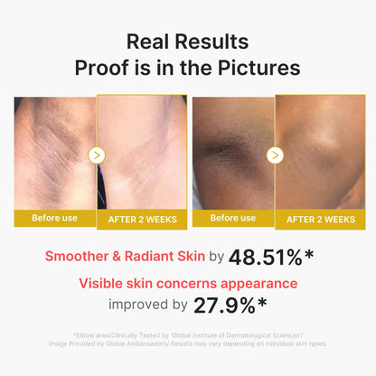 medicube Body Peel Shot with Hypochlorous Acid, For Exfoliating & Soothing