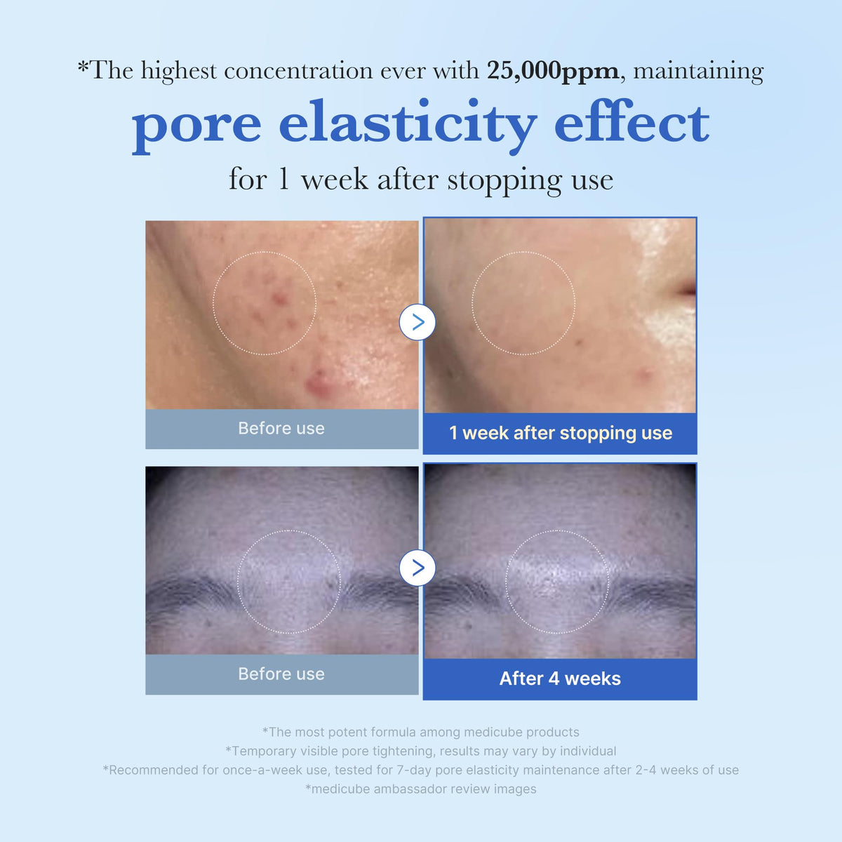 medicube Exosome Shot Zero 2,000 PPM Spicule Facial Serum For Pores & Sebum