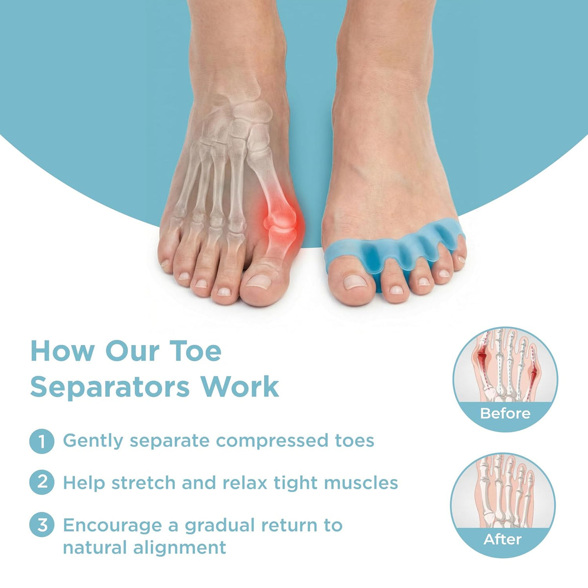 Mind Bodhi Toe Separators/Toe Spacers - Men & Women - Large Size - Blue