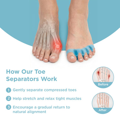 Mind Bodhi Toe Separators/Toe Spacers - Men & Women - Large Size - Blue