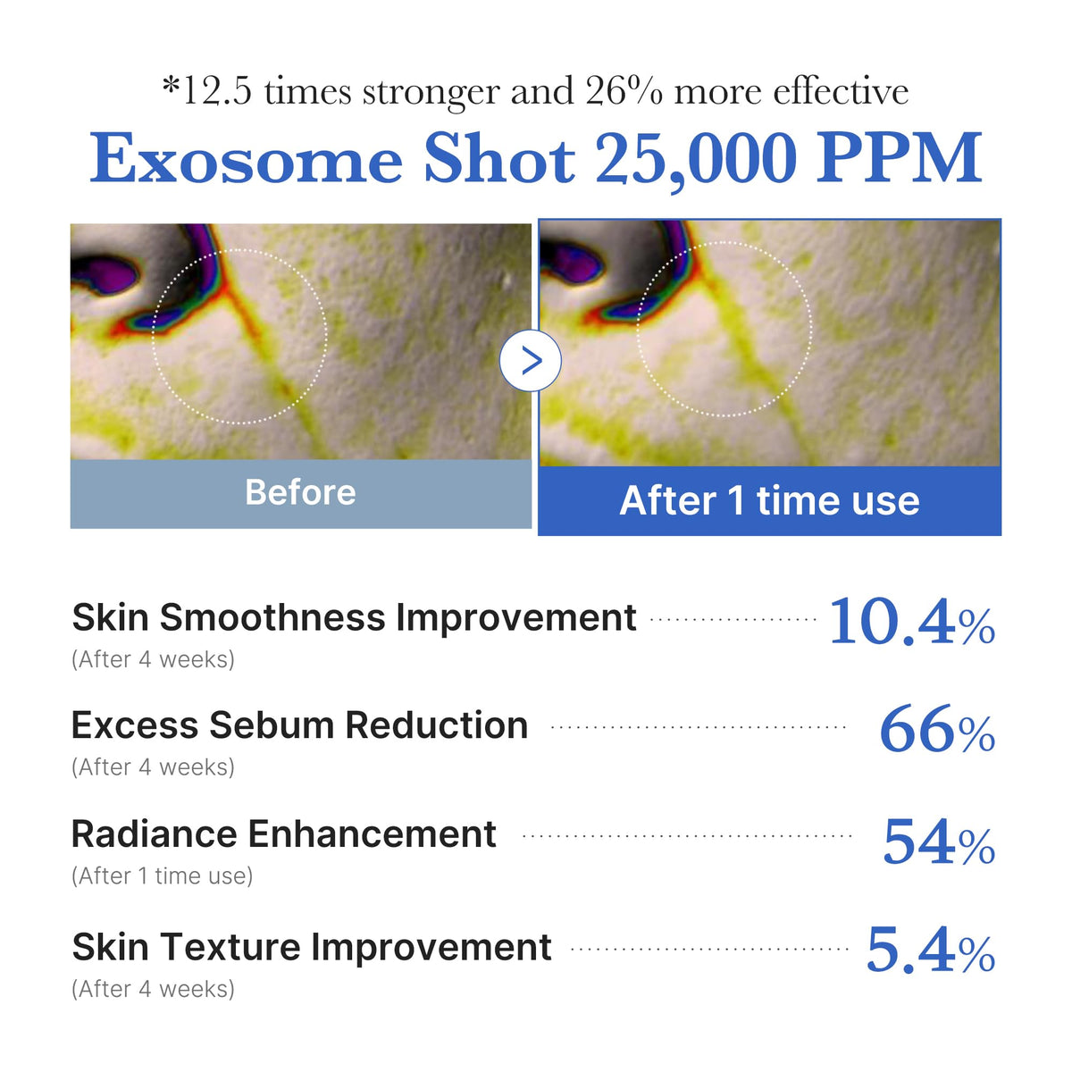 medicube Exosome Shot Zero 2,000 PPM Spicule Facial Serum For Pores & Sebum