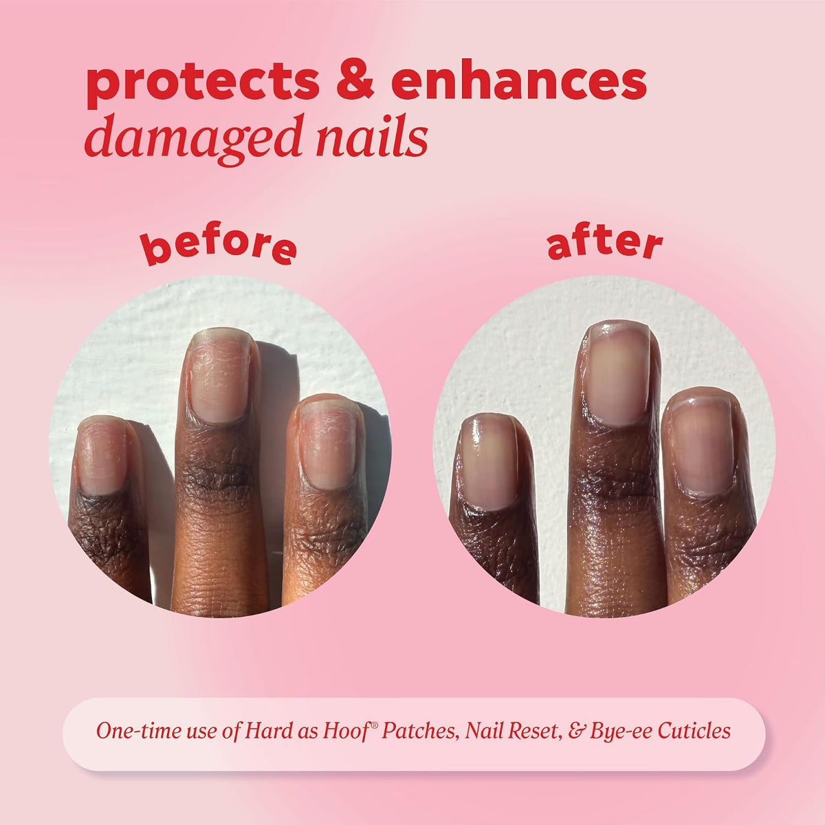 Onyx Professional Hard as Hoof Nail Repair Patches, 20 Patches