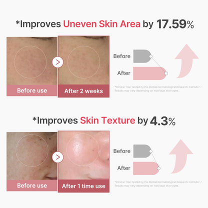 medicube Exosome Shot Zero 2,000 PPM Spicule Facial Serum For Pores & Sebum