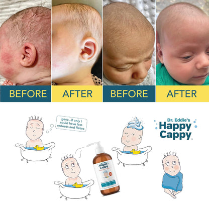 Happy Cappy Medicated Shampoo and Body Wash with Beanie Brush - 2 Pieces