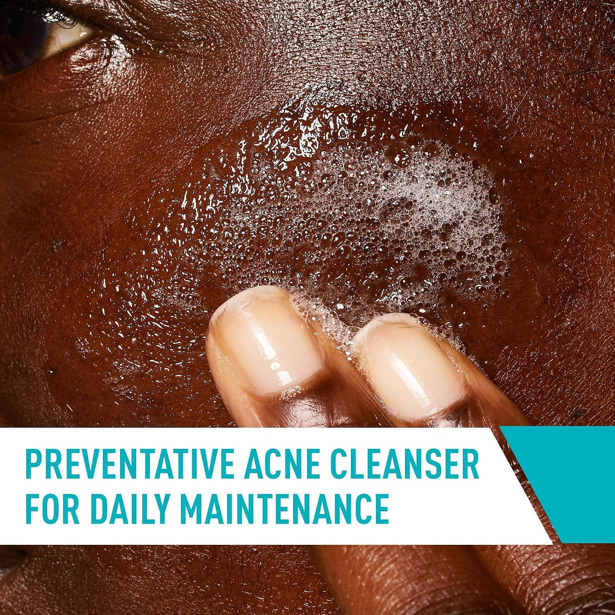 CeraVe Acne Control Cleanser, Face Wash with 2% Salicylic Acid, 8 oz