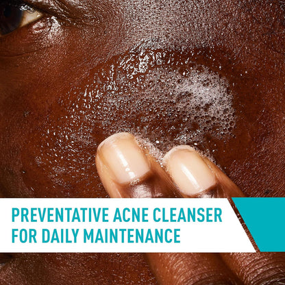 CeraVe Acne Control Cleanser, Face Wash with 2% Salicylic Acid, 8 oz