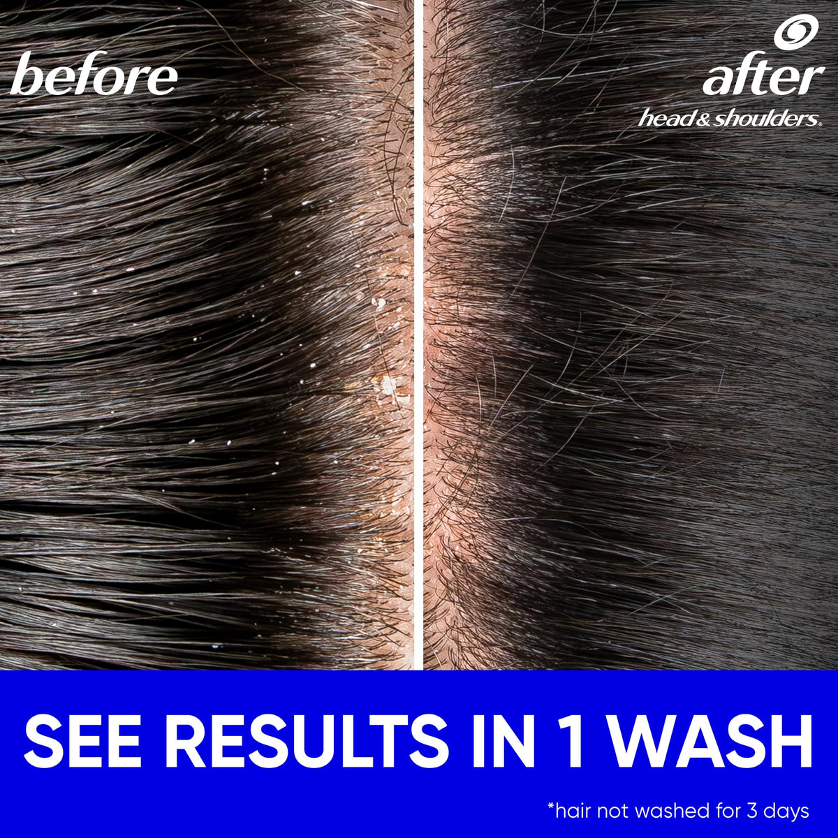 Head and Shoulders Classic Clean Anti-Dandruff 2 in 1 Paraben Free Shampoo and Conditioner, 32.1 fl oz