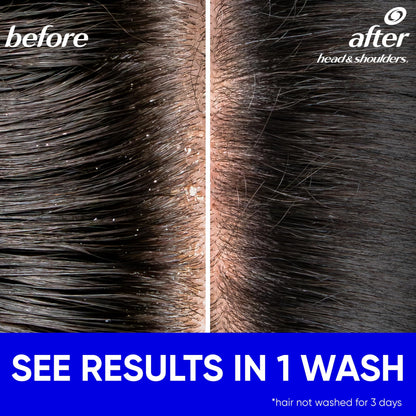 Head and Shoulders Classic Clean Anti-Dandruff 2 in 1 Paraben Free Shampoo and Conditioner, 32.1 fl oz