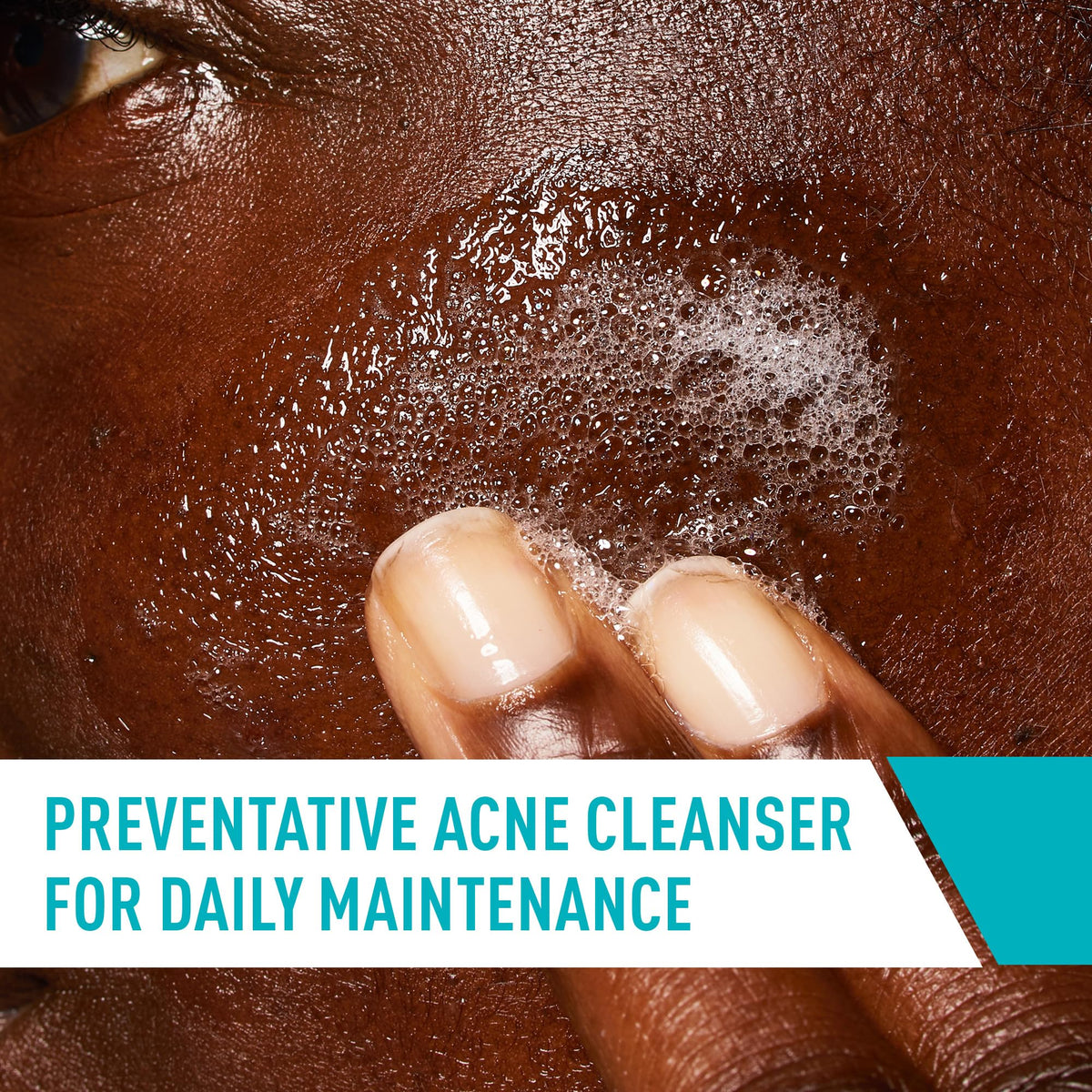 CeraVe Acne Control Cleanser, Face Wash with 2% Salicylic Acid, 8 oz
